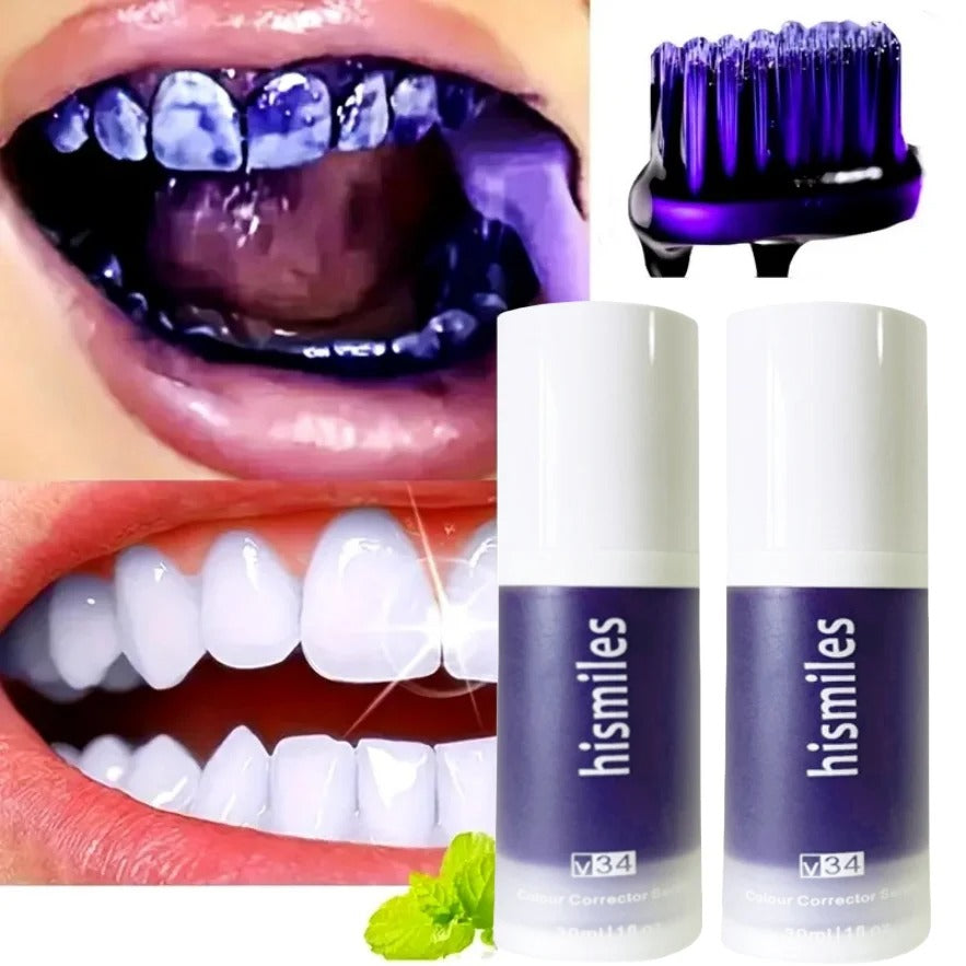 Hismile Purple Teeth Whitening Toothpaste – Instant Brightening Formula