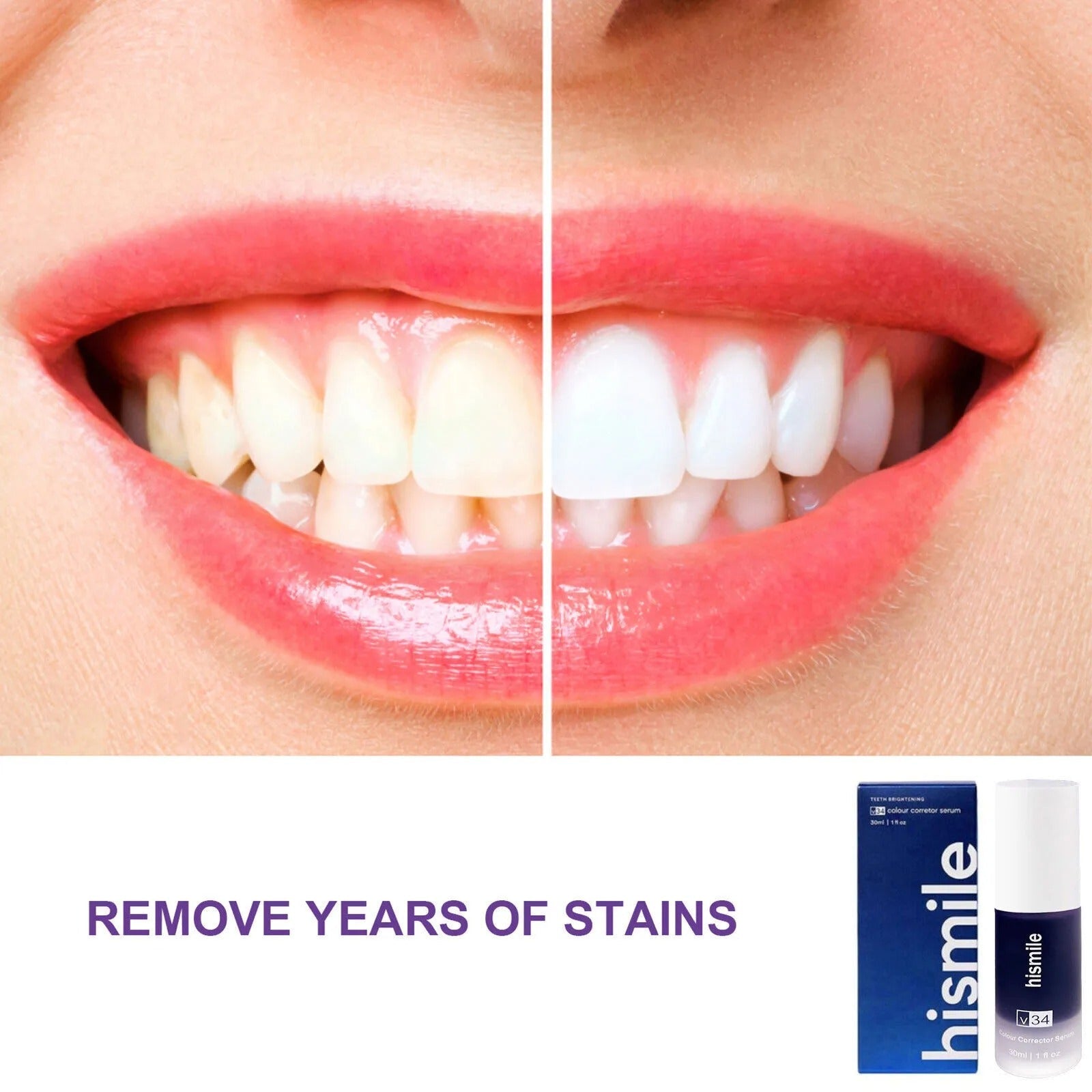 Hismile Purple Teeth Whitening Toothpaste – Instant Brightening Formula